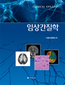 �ӻ�����-Clinical Epilepsy